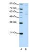 Zinc Finger Protein 92 antibody, NBP1-80415, Novus Biologicals, Western Blot image 