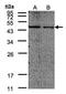 Eukaryotic Translation Initiation Factor 4A2 antibody, GTX101485, GeneTex, Western Blot image 