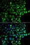 RAB31, Member RAS Oncogene Family antibody, LS-C349198, Lifespan Biosciences, Immunofluorescence image 