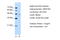 Fumarylacetoacetate Hydrolase antibody, 29-619, ProSci, Western Blot image 