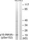 Cyclin-dependent kinase inhibitor 2A, isoforms 1/2/3 antibody, PA5-39802, Invitrogen Antibodies, Western Blot image 