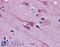 Gastrulation Brain Homeobox 2 antibody, 45-659, ProSci, Western Blot image 