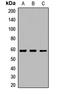 Lysophosphatidylcholine acyltransferase 1 antibody, LS-C668295, Lifespan Biosciences, Western Blot image 