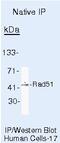 RAD51 Recombinase antibody, MA5-14419, Invitrogen Antibodies, Immunoprecipitation image 