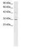 Cyclin Dependent Kinase 7 antibody, PA1-24252, Invitrogen Antibodies, Western Blot image 