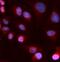 ATPase Copper Transporting Beta antibody, FNab09849, FineTest, Immunofluorescence image 