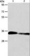 Aminoacylase 3 antibody, LS-C404439, Lifespan Biosciences, Western Blot image 