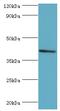 Sulfotransferase Family 2B Member 1 antibody, MBS1496676, MyBioSource, Western Blot image 