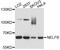 Negative Elongation Factor Complex Member B antibody, STJ113924, St John