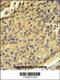 Cathepsin H antibody, 62-866, ProSci, Immunohistochemistry paraffin image 