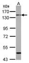RNA Binding Motif Protein 26 antibody, NBP2-20105, Novus Biologicals, Western Blot image 
