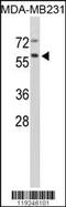 Cathepsin F antibody, 62-331, ProSci, Western Blot image 