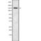 Tensin 2 antibody, PA5-67976, Invitrogen Antibodies, Western Blot image 