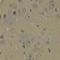 Phosphoinositide-3-Kinase Regulatory Subunit 1 antibody, A0054, ABclonal Technology, Immunohistochemistry paraffin image 