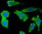 S100 Calcium Binding Protein B antibody, NBP2-67572, Novus Biologicals, Immunofluorescence image 
