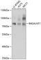 Beta-1,4-N-Acetyl-Galactosaminyltransferase 1 antibody, 19-193, ProSci, Western Blot image 