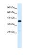 Complement Component 4 Binding Protein Beta antibody, orb329748, Biorbyt, Western Blot image 