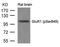 Glutamate Ionotropic Receptor AMPA Type Subunit 1 antibody, PA5-37588, Invitrogen Antibodies, Western Blot image 