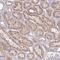 Chemerin Chemokine-Like Receptor 1 antibody, NBP2-13847, Novus Biologicals, Immunohistochemistry paraffin image 