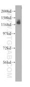 Electrogenic sodium bicarbonate cotransporter 1 antibody, 11885-1-AP, Proteintech Group, Western Blot image 