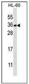 Phosphatidylinositol Transfer Protein Beta antibody, AP53310PU-N, Origene, Western Blot image 