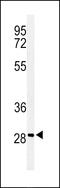 Rho GTPase Activating Protein 19 antibody, 64-126, ProSci, Western Blot image 