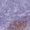 Cell Division Cycle Associated 4 antibody, NBP2-32457, Novus Biologicals, Immunohistochemistry paraffin image 
