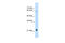 Recombining binding protein suppressor of hairless-like protein antibody, 28-054, ProSci, Western Blot image 