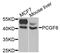 Polycomb Group Ring Finger 6 antibody, abx004408, Abbexa, Western Blot image 