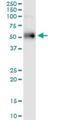 ETS Variant 1 antibody, H00002115-M01, Novus Biologicals, Western Blot image 