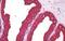 Keratin 8 antibody, MBS245523, MyBioSource, Immunohistochemistry paraffin image 