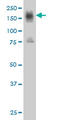 CD49D antibody, LS-C197551, Lifespan Biosciences, Western Blot image 