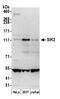 Salt Inducible Kinase 2 antibody, NBP1-42690, Novus Biologicals, Western Blot image 