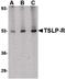 Cytokine Receptor Like Factor 2 antibody, PA5-20378, Invitrogen Antibodies, Western Blot image 