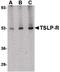 Cytokine receptor-like factor 2 antibody, PA5-20378, Invitrogen Antibodies, Western Blot image 