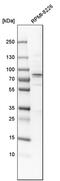 Acyl-CoA Synthetase Short Chain Family Member 2 antibody, PA5-52059, Invitrogen Antibodies, Western Blot image 