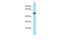 Actin Related Protein 6 antibody, PA5-45981, Invitrogen Antibodies, Western Blot image 