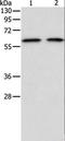 ADAM Metallopeptidase Domain 2 antibody, LS-C401179, Lifespan Biosciences, Western Blot image 