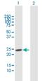 TSPY Like 4 antibody, H00023270-B01P, Novus Biologicals, Western Blot image 