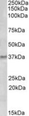 GTP cyclohydrolase 1 antibody, MBS421787, MyBioSource, Western Blot image 