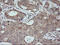 Mitogen-Activated Protein Kinase 9 antibody, M02706-1, Boster Biological Technology, Immunohistochemistry paraffin image 