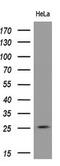 Rho Family GTPase 1 antibody, MA5-25252, Invitrogen Antibodies, Western Blot image 