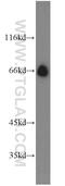 Decapping MRNA 1A antibody, 22373-1-AP, Proteintech Group, Western Blot image 