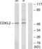 Cyclin Dependent Kinase Like 2 antibody, LS-C119184, Lifespan Biosciences, Western Blot image 
