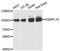 Oxysterol Binding Protein Like 10 antibody, LS-C748261, Lifespan Biosciences, Western Blot image 