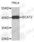 Branched Chain Amino Acid Transaminase 2 antibody, A3761, ABclonal Technology, Western Blot image 