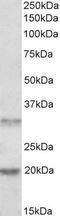 Asparaginase Like 1 antibody, GTX88848, GeneTex, Western Blot image 