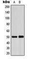 ADP Dependent Glucokinase antibody, orb224131, Biorbyt, Western Blot image 
