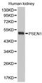 Presenilin 1 antibody, STJ25167, St John