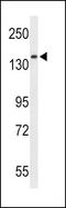 Reversion Inducing Cysteine Rich Protein With Kazal Motifs antibody, GTX80458, GeneTex, Western Blot image 